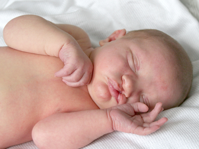 Children born with cleft lip, cleft palate or other craniofacial anomalies may have multiple conditions that require a team of specialists to coordinate care.