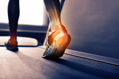 Arthritis
