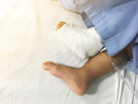 Limb Deformity