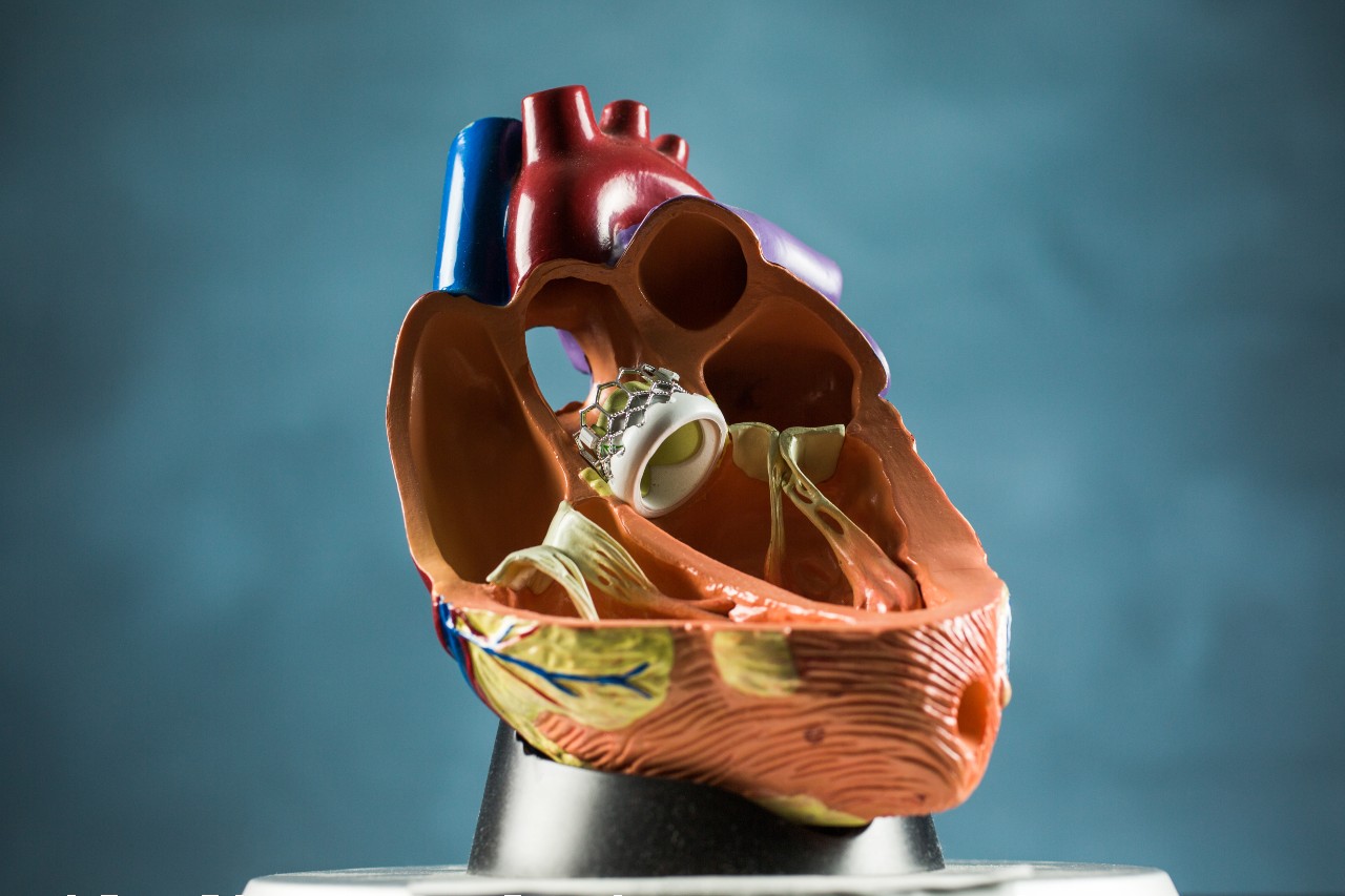 heart model with TAVR valve  image