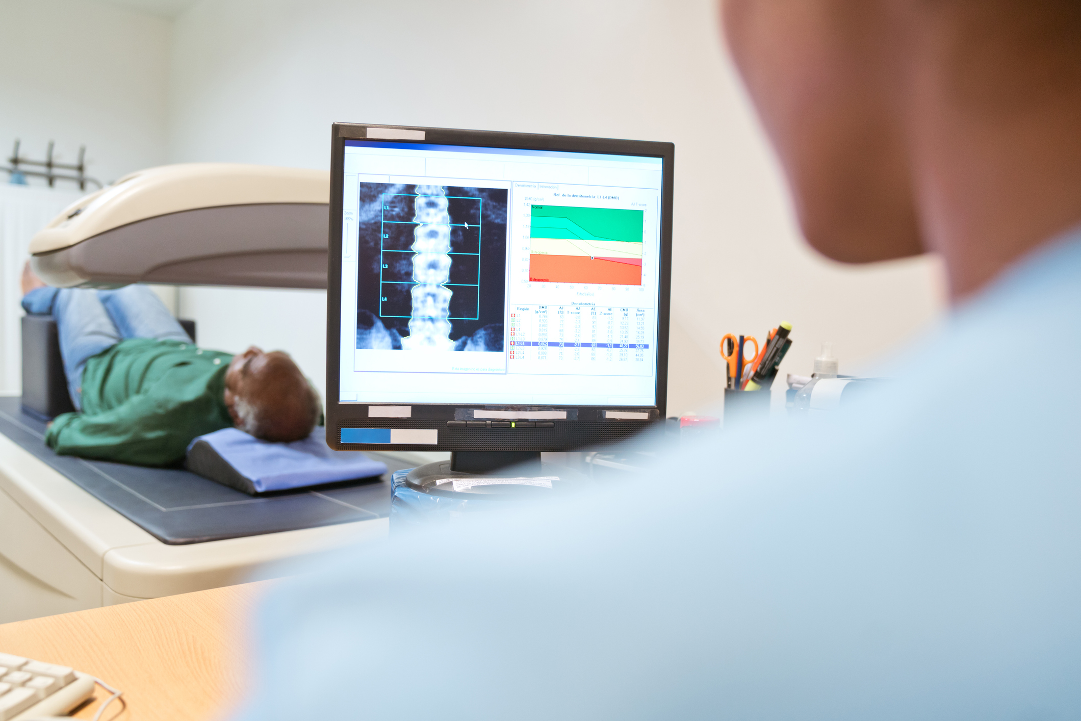 Bone Health Evaluation