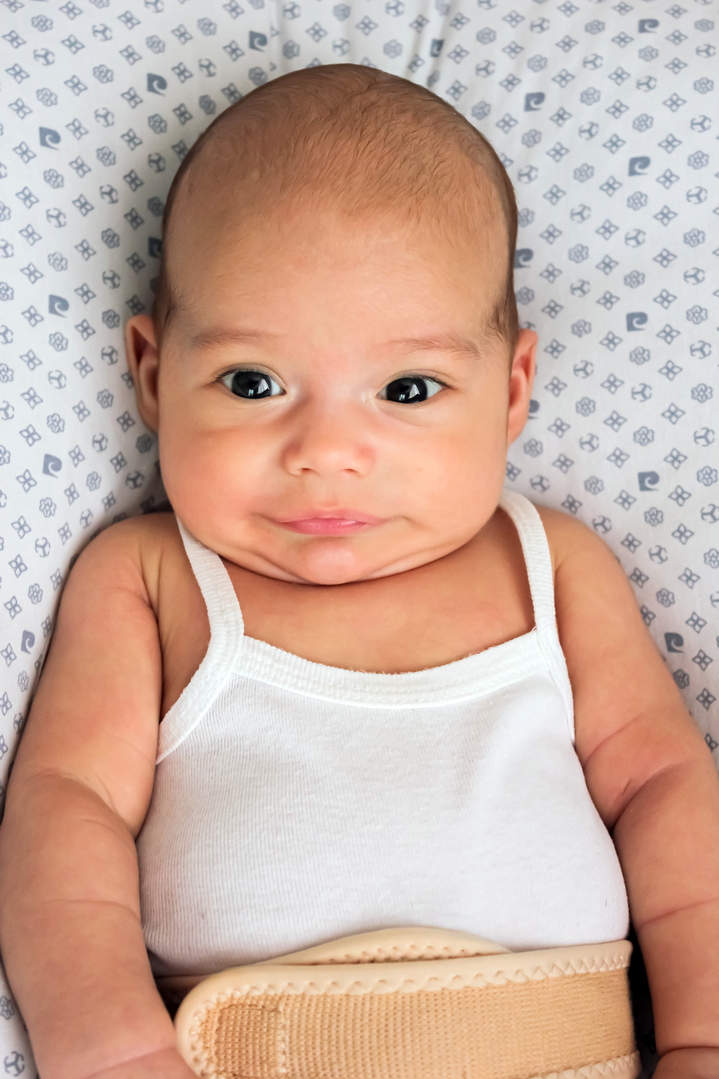 Baby in an umbilical hernia bandage