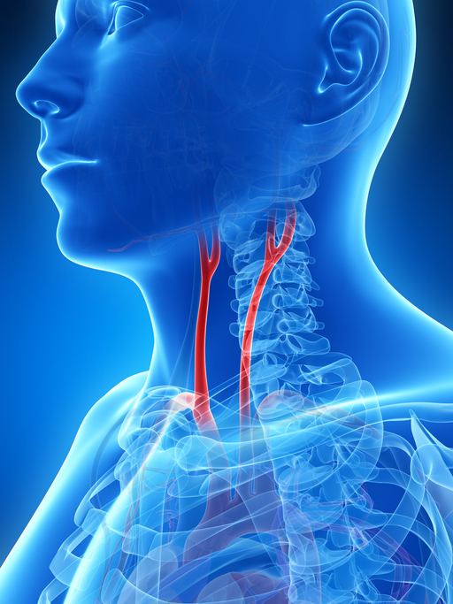 Carotid