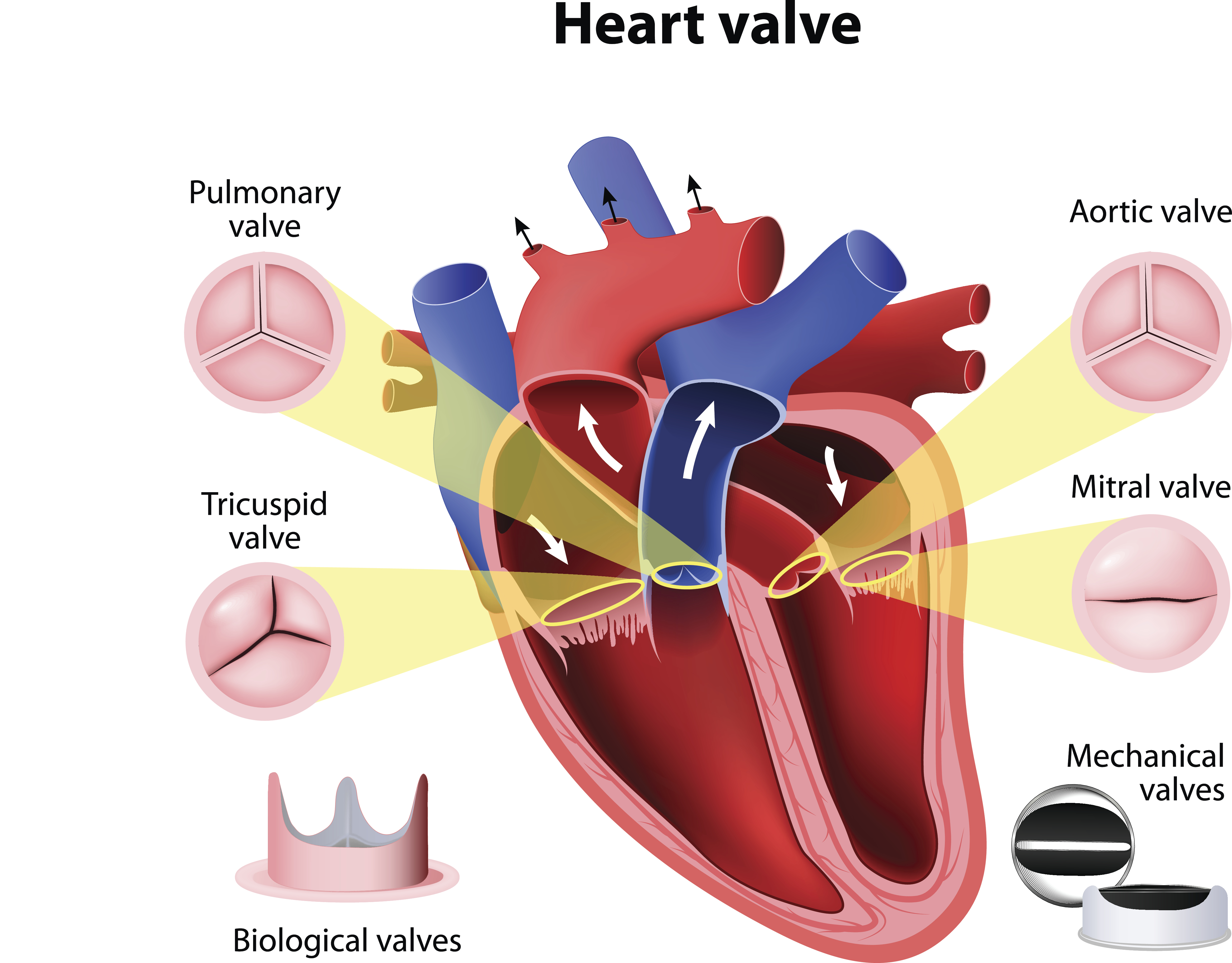 Heart Valve