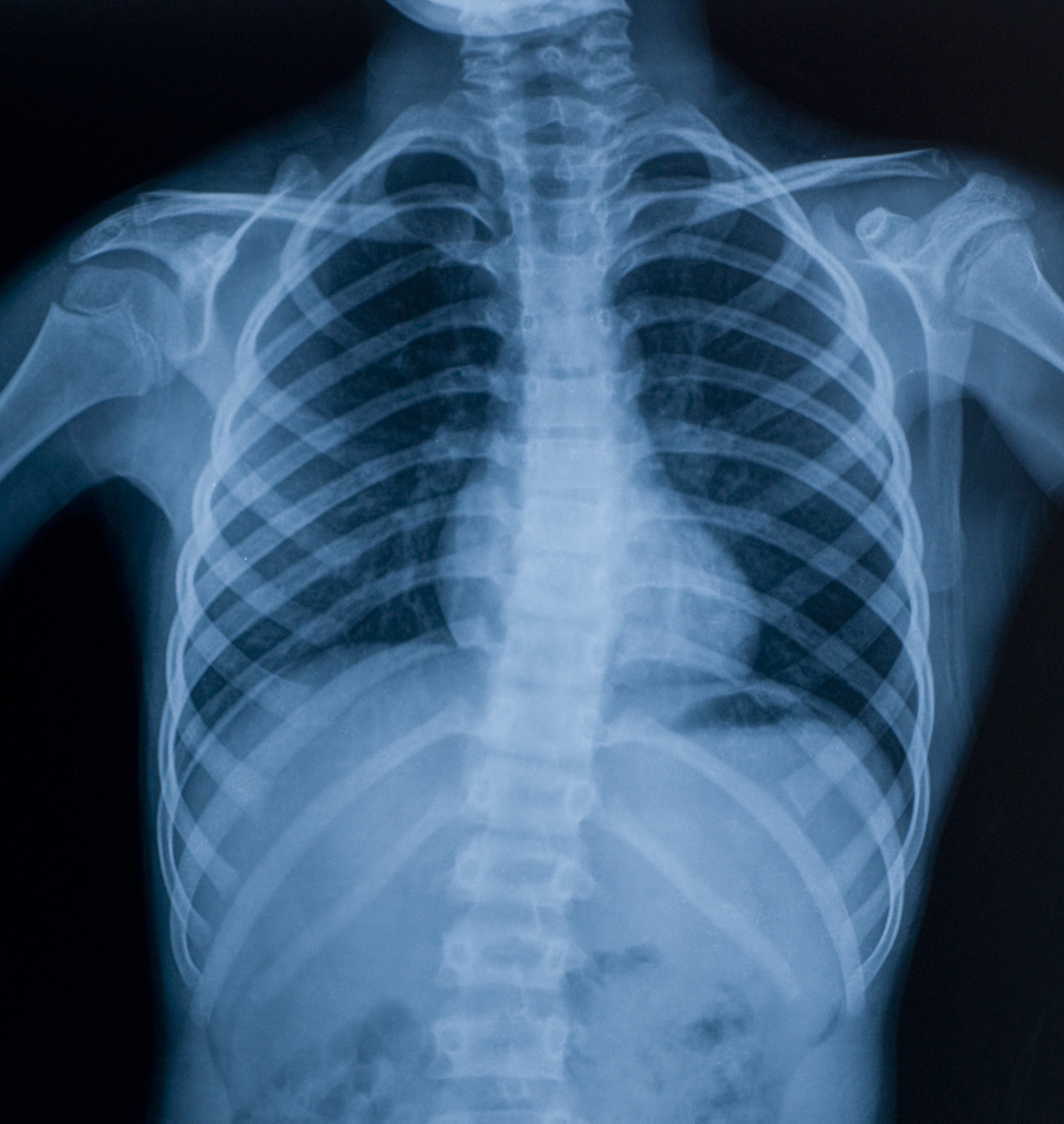 Thoracic