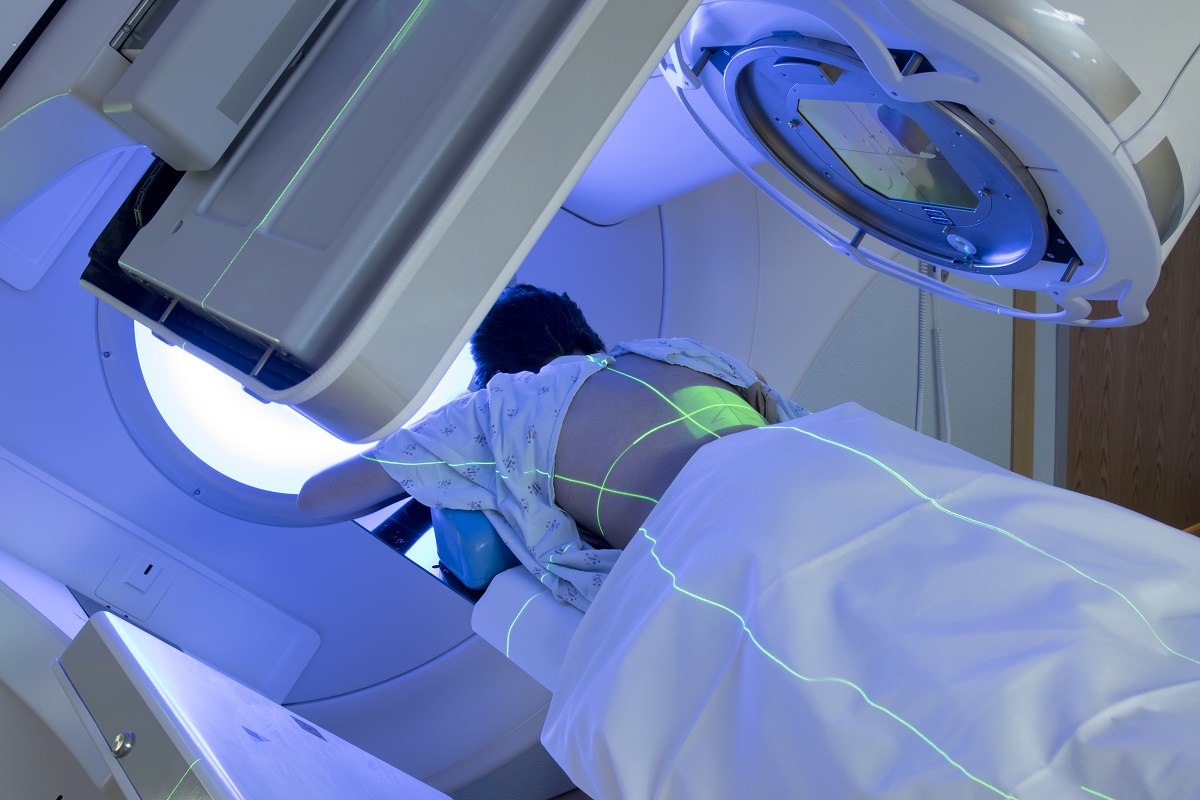 stock image of radiation radiotherapy session image