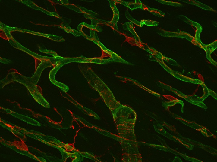 Chappell muscle vessels image