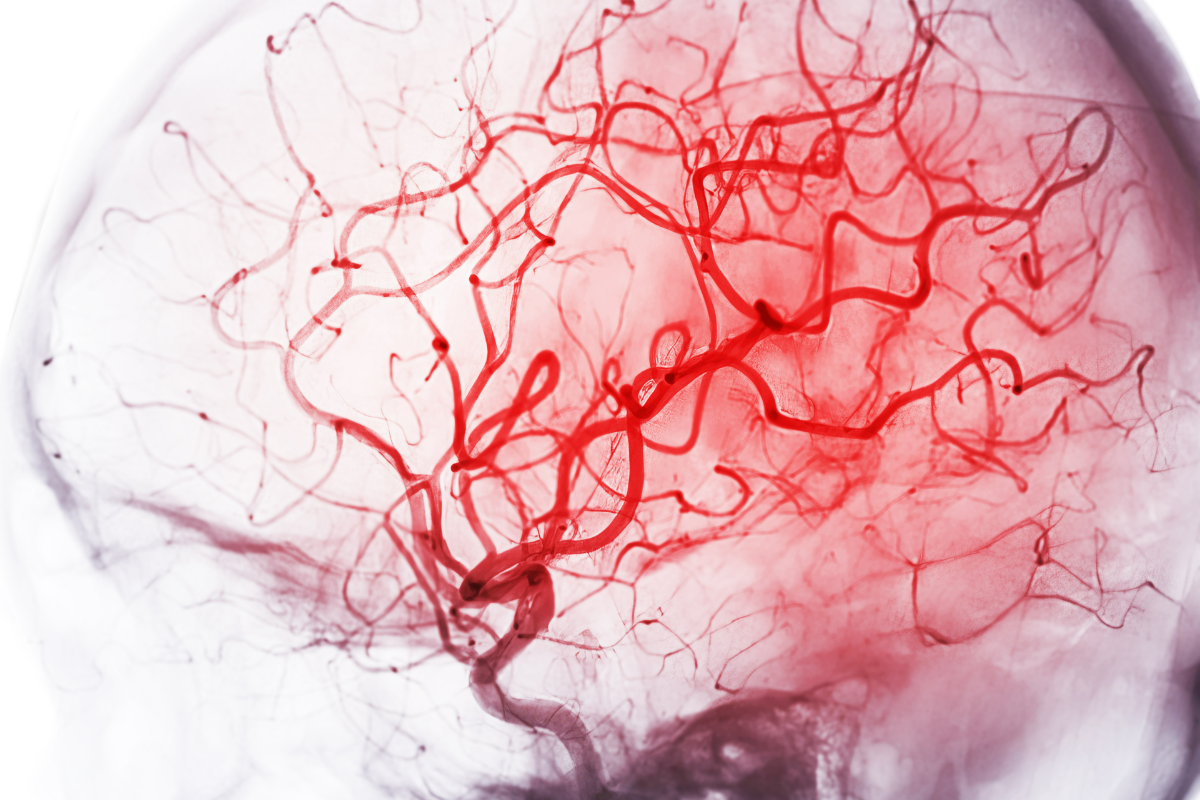 Vascular system brain