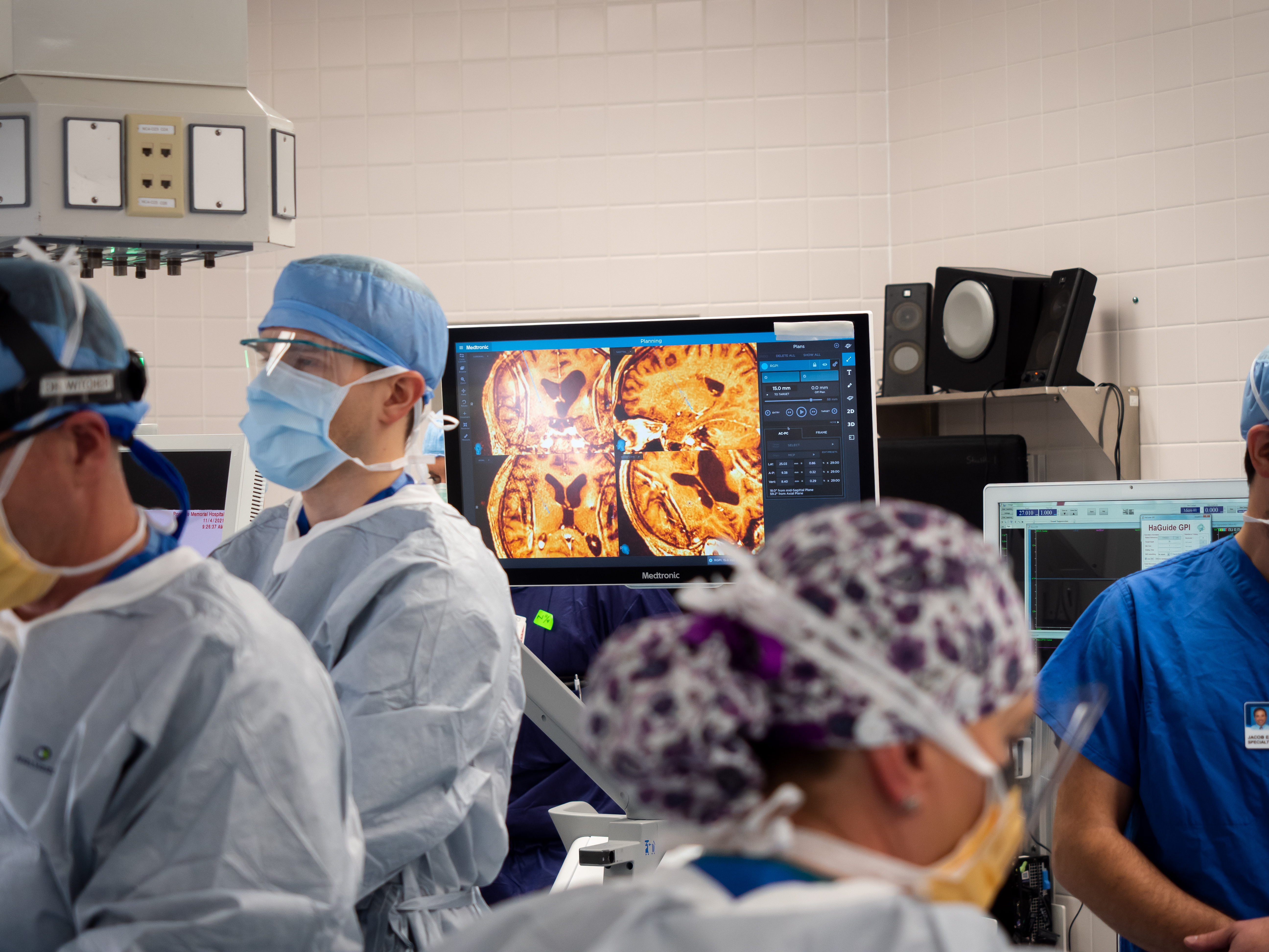 Open Skull Base Surgery